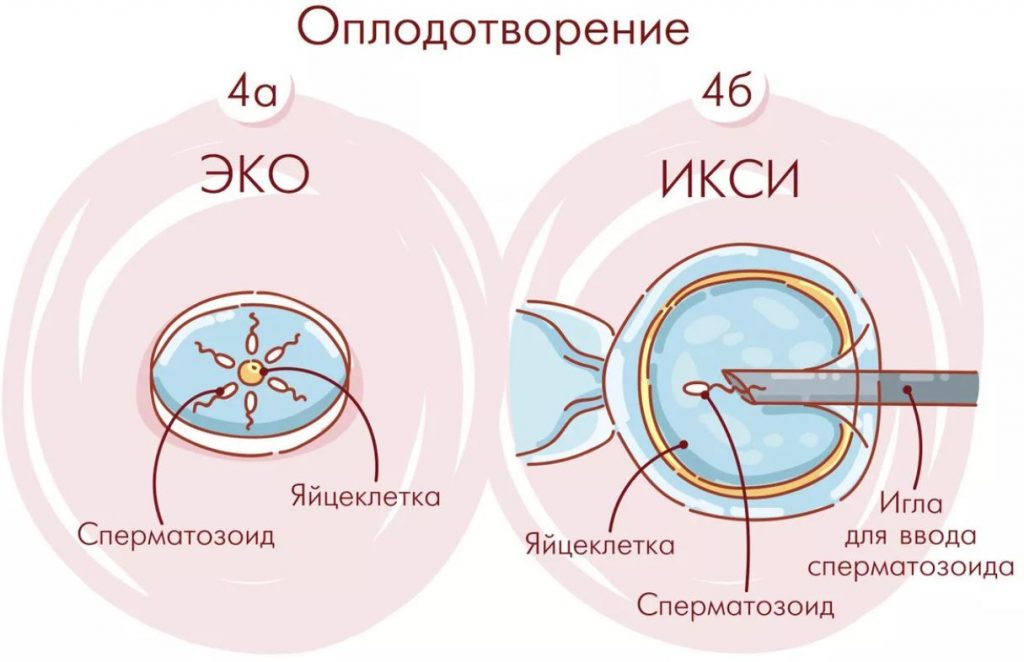 эко и икси